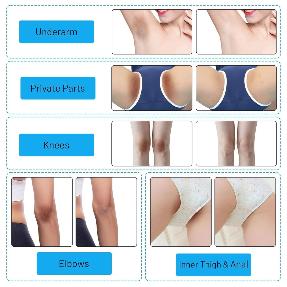 Skin Lightening Gel for Body & Intimate Areas with Niacinamide & Arbutin
