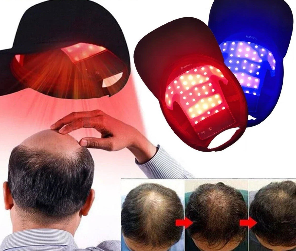 LED Hair Growth Cap – Red Light Therapy Hat 630nm