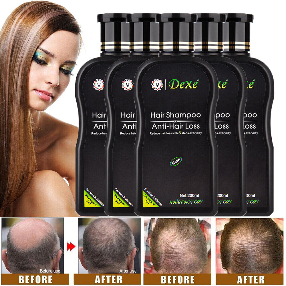 200ML DEXE Anti-Hair Loss Shampoo Natural Herbal Hair Regrowth for