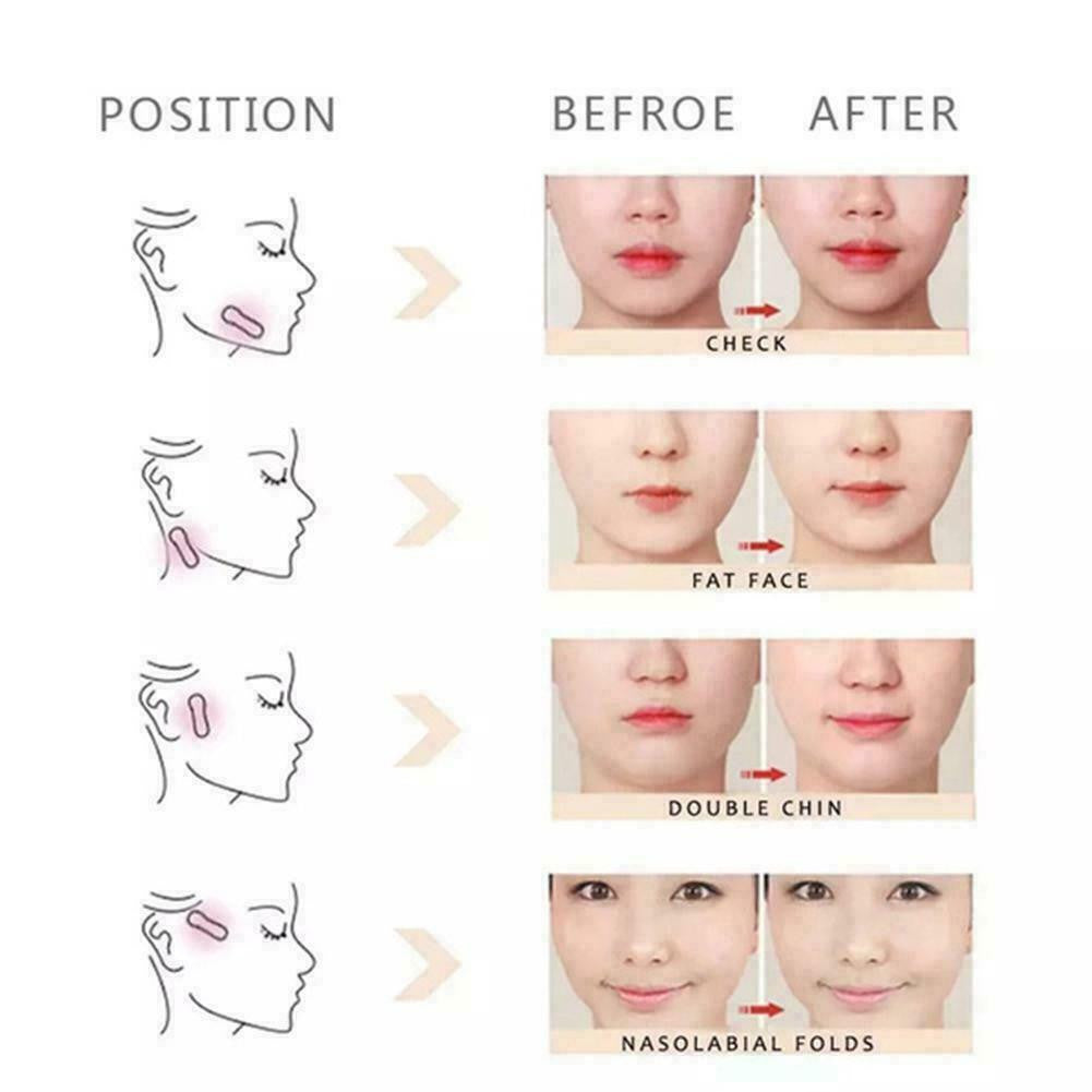 160PCS Face Lift Tape & Bands for V-Shaped Face - Skin Firming & Wrinkle Reduction