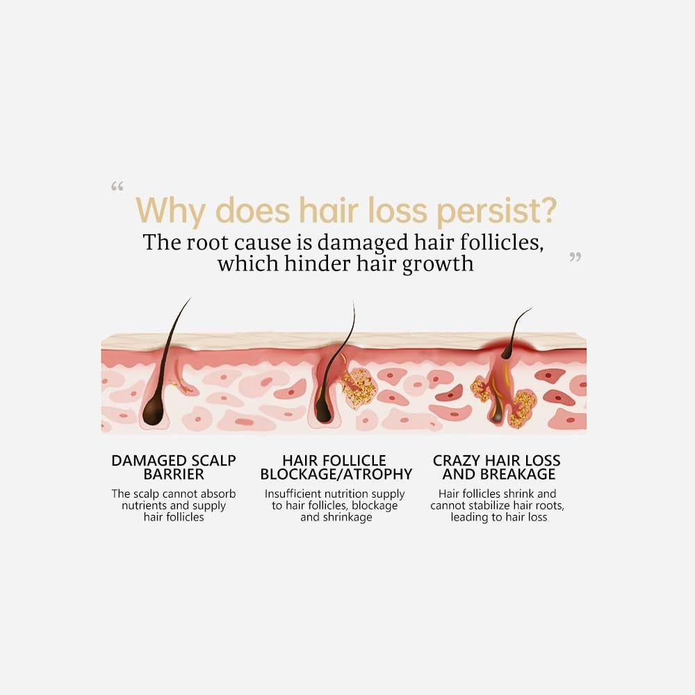 Ginger Hair Loss Shampoo - Anti Hair Loss & Growth Formula 100g