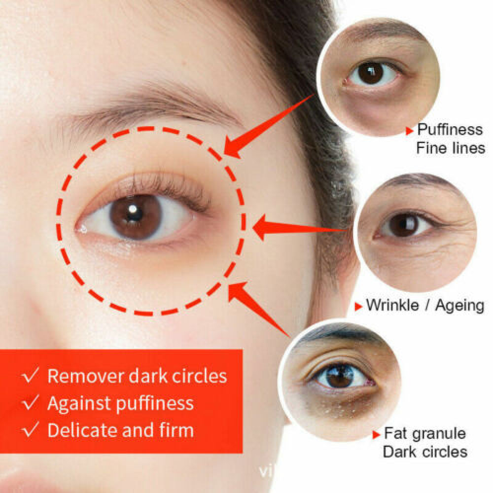 3PCS Eye Cream for Dark Circles & Wrinkles - Firming, Depuffing & Moisturizing