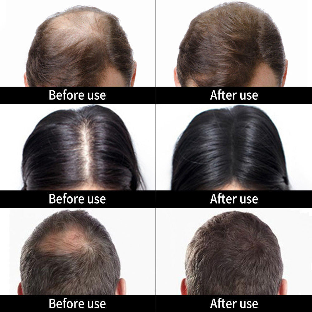Hair Building Fibers Medium Brown 27.5g