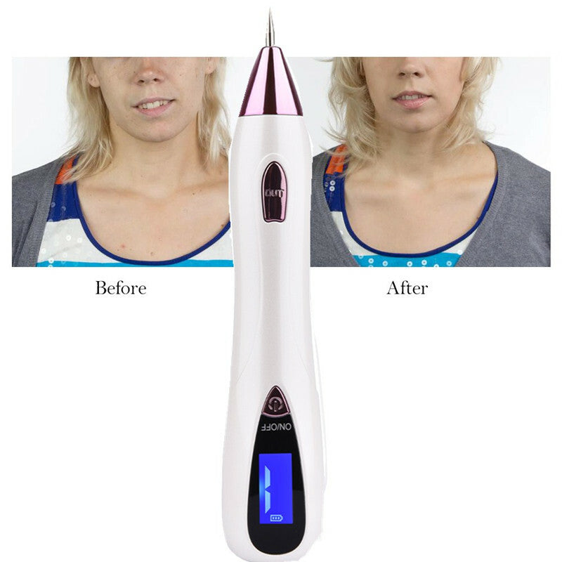 Laser Plasma Pen Skin Mole Dark Spot Remover Machine for Wart Tattoo
