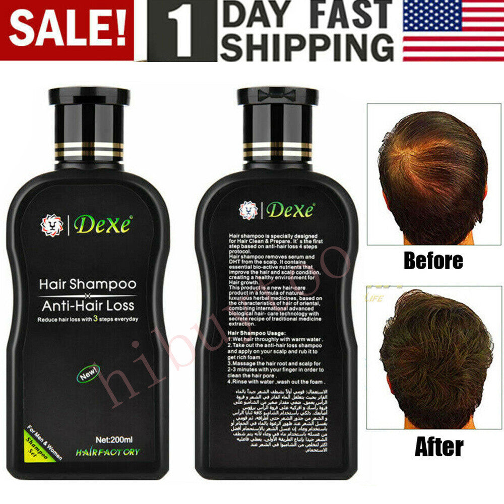Anti-Hair Loss Shampoo 200ml - Herbal Daily Cleanser