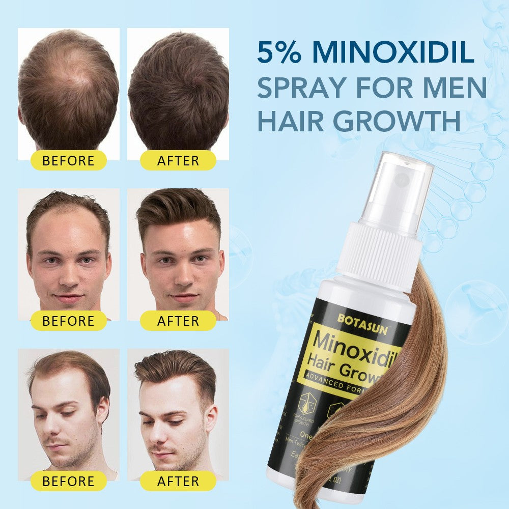 5% Minoxidil Hair Regrowth Spray for Men - 3 Month Supply