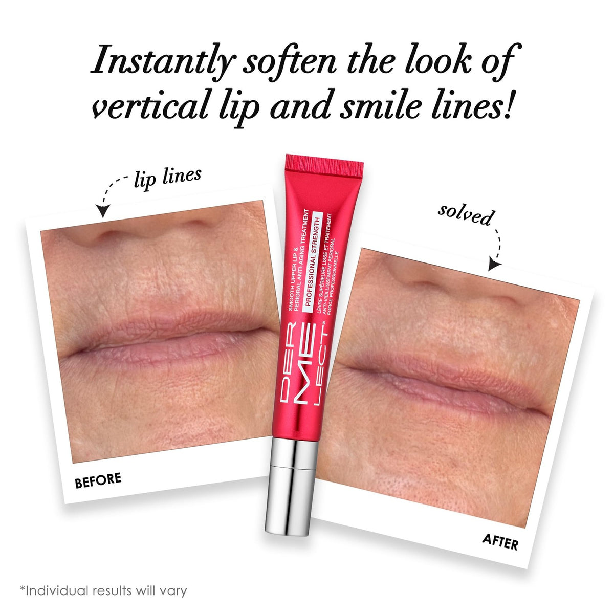Lip Wrinkle Treatment and Primer for Fine Lines & Lip Smoothening