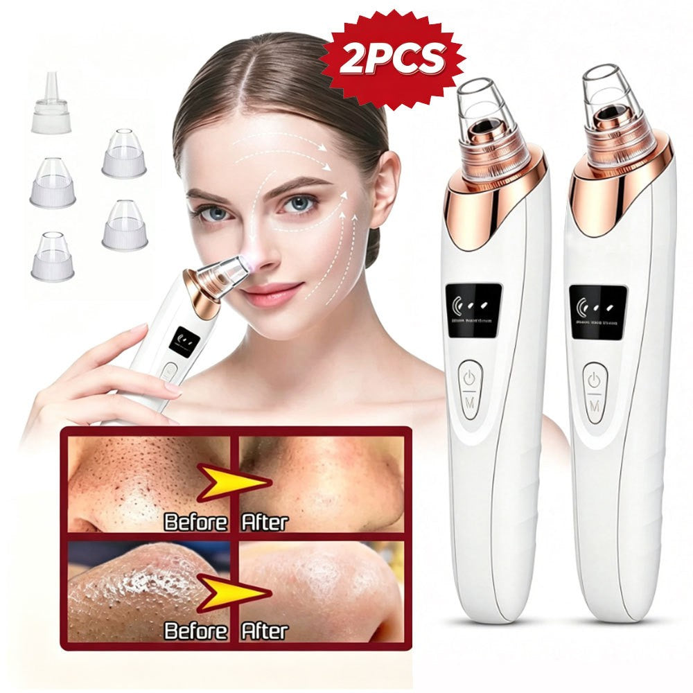 Electric Blackhead Vacuum Pore Cleaner Kit - USB Rechargeable Facial Tool
