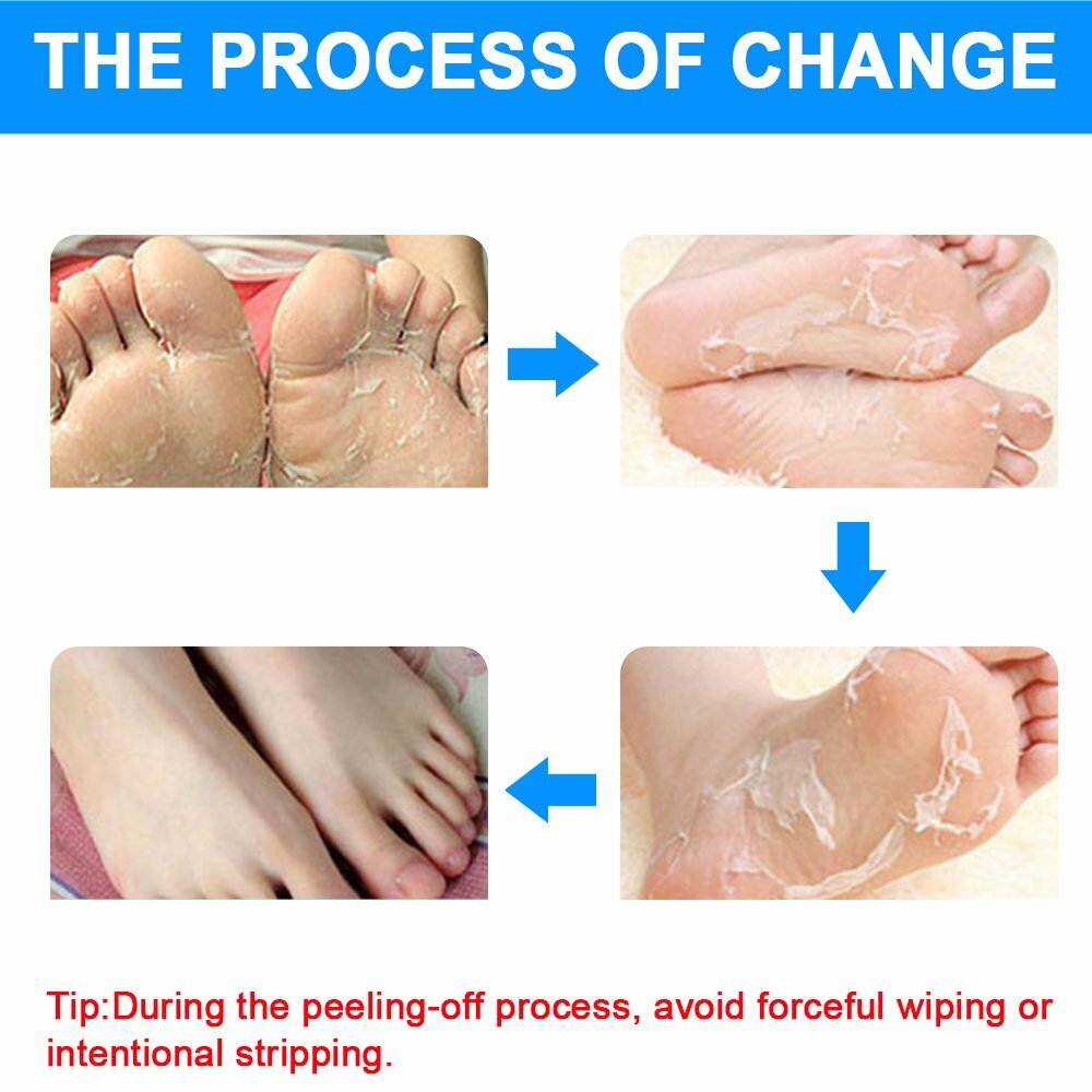 2-Pairs Foot Peel Masks for Soft Feet, Exfoliating Dead Skin & Callus