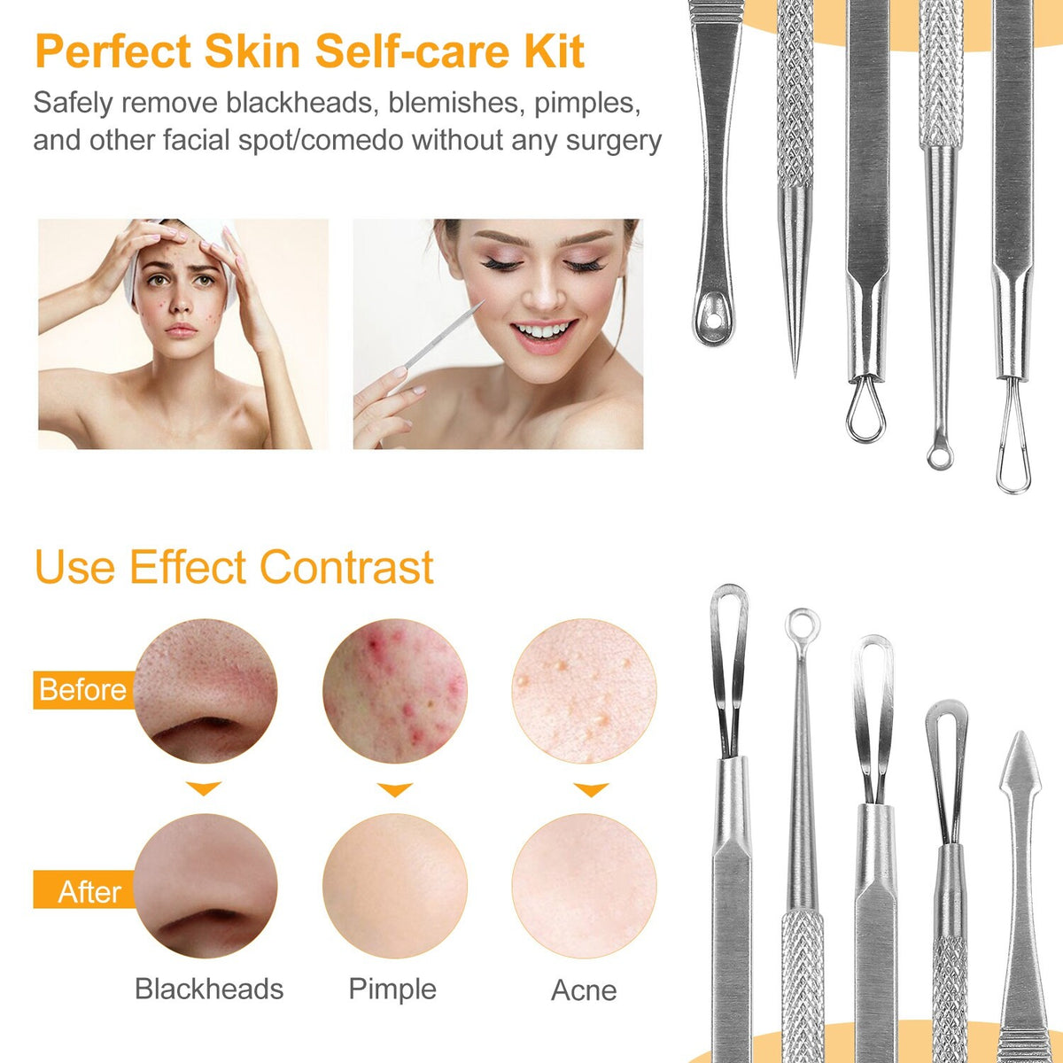 Blackhead Remover Kit 5 Pcs Facial Pimple Extractor Tools Set