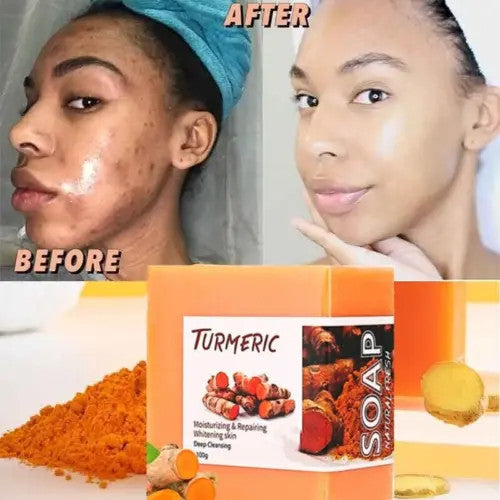 Turmeric & Ginger Natural Soap for Skin Brightening and Spot Removal - 100g