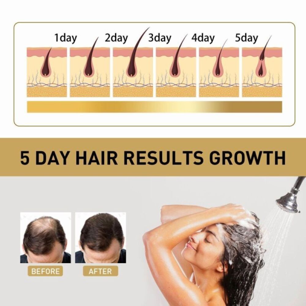 Anti-Hair Loss Shampoo Chinese Herbal Hair Regrowth Growth For Men
