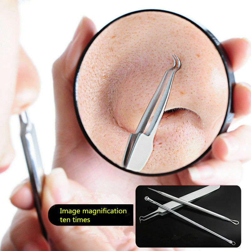 Blackhead Remover Tool Kit - 9 Pcs Acne & Comedone Extraction Set