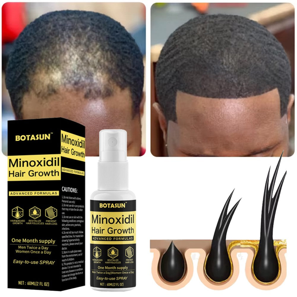 Minoxidil 5% Spray Men Hair Regrowth Treatment Solution 1 Month