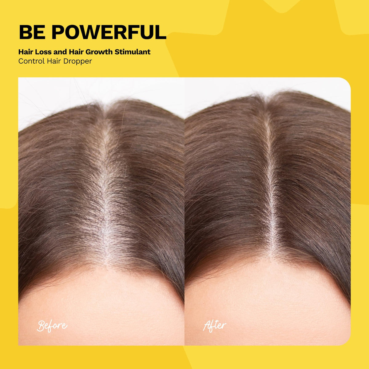 Ginger Root Extract Hair Growth Serum - 2 Fl Oz
