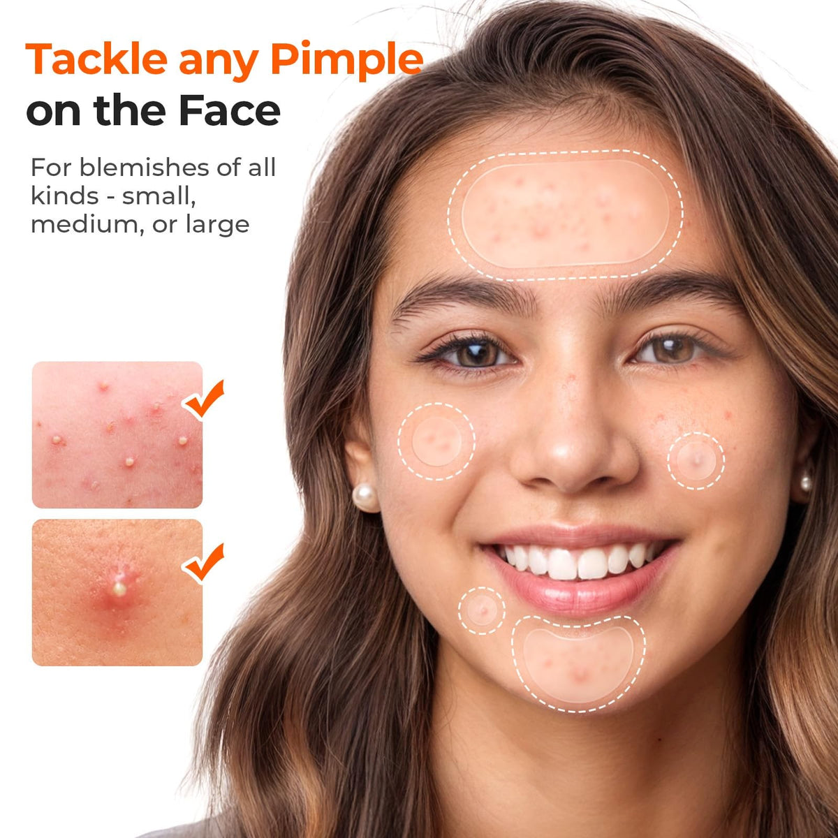 Hydrocolloid Acne Patches, 443 Count Variety Pack - 5 Sizes