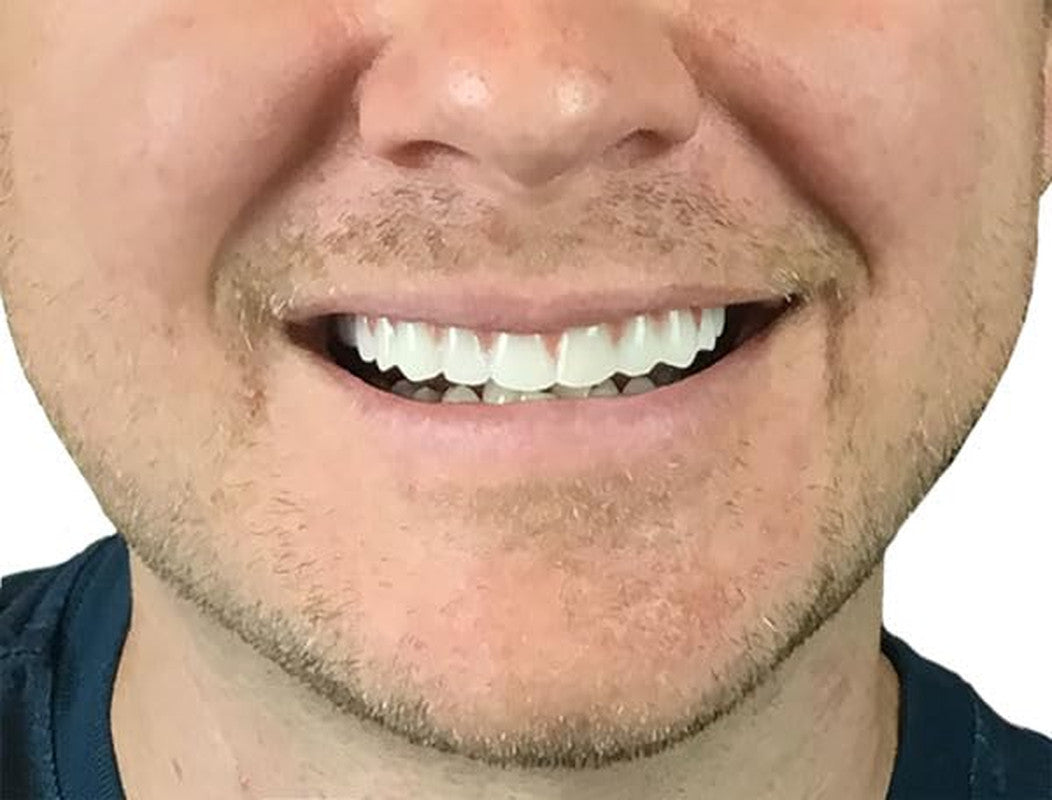 Comfort Fit Flex Natural Shade Teeth - Custom Fit Temporary Smile Enhancer