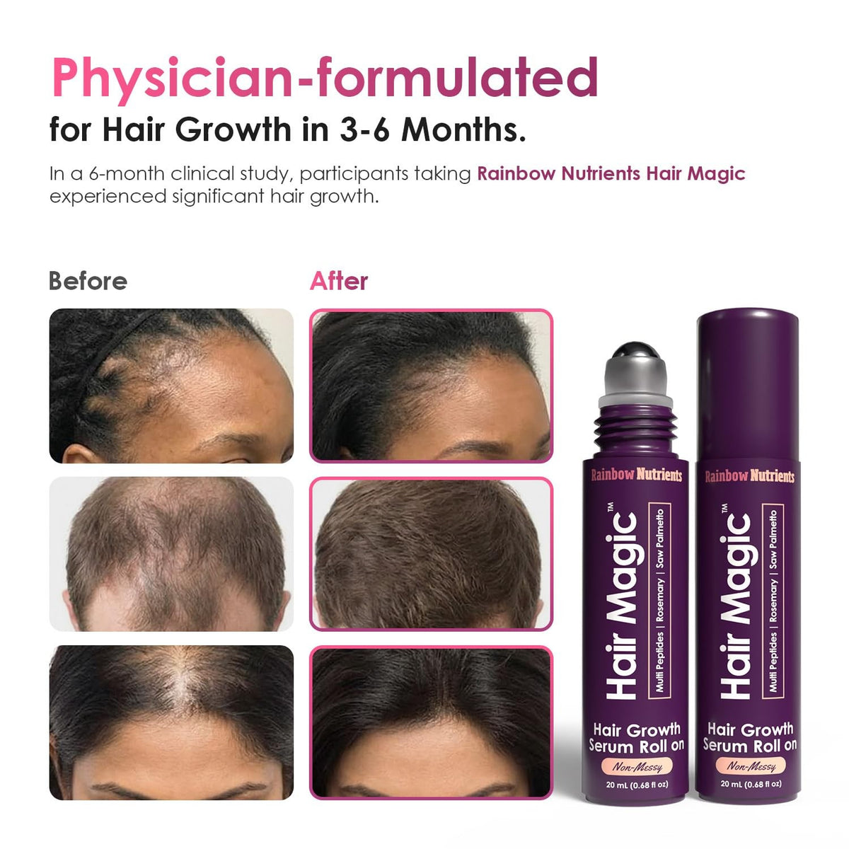 Hair Growth Serum Roll On with Rosemary Oil & Peptides