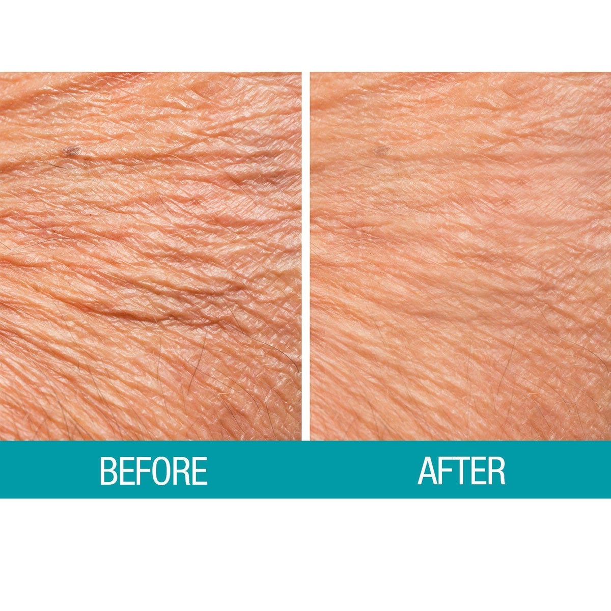 Crepe Be Gone Body Souffle - Classic 3 ounce Ultra Hydrating Skin 2