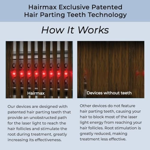 WHITE/BLUE - HAIRMAX ULTIMA 12 HAIR GROWTH LASER COMB
