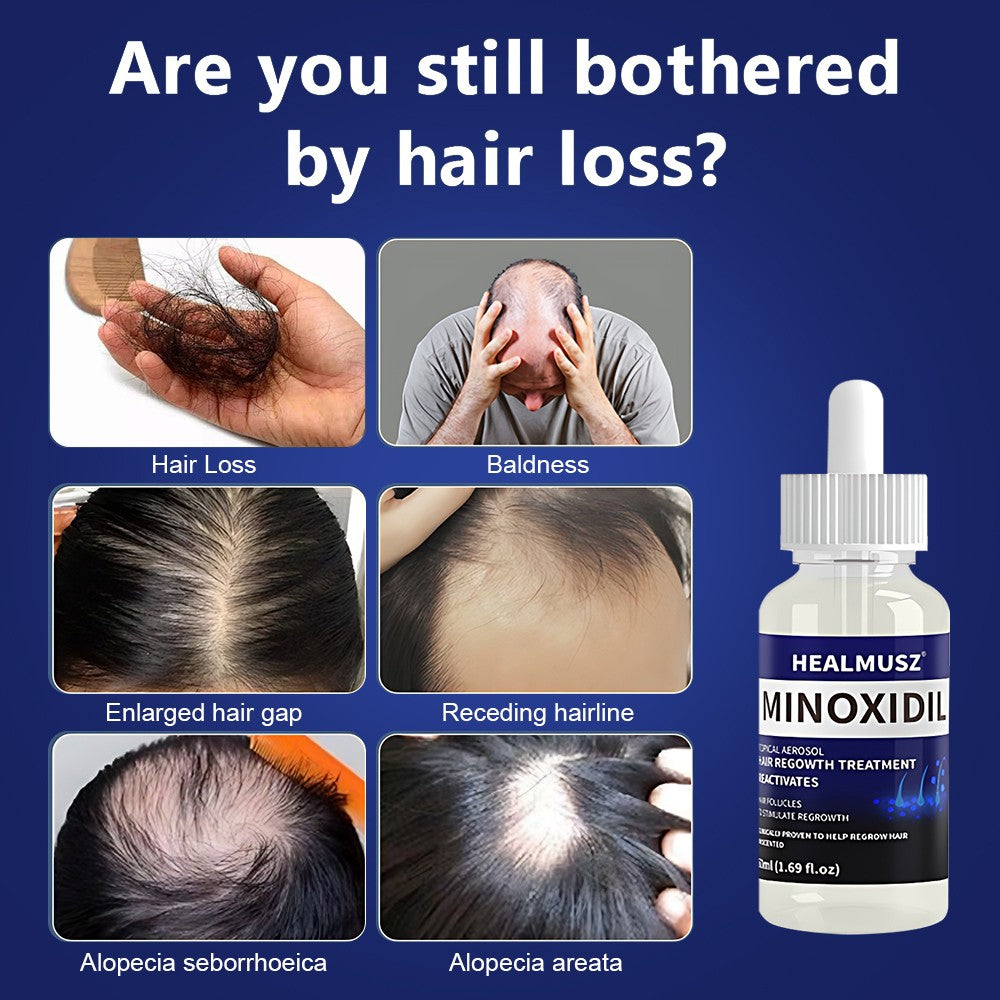 Minoxidil 5% Hair Regrowth Solution for Men & Women