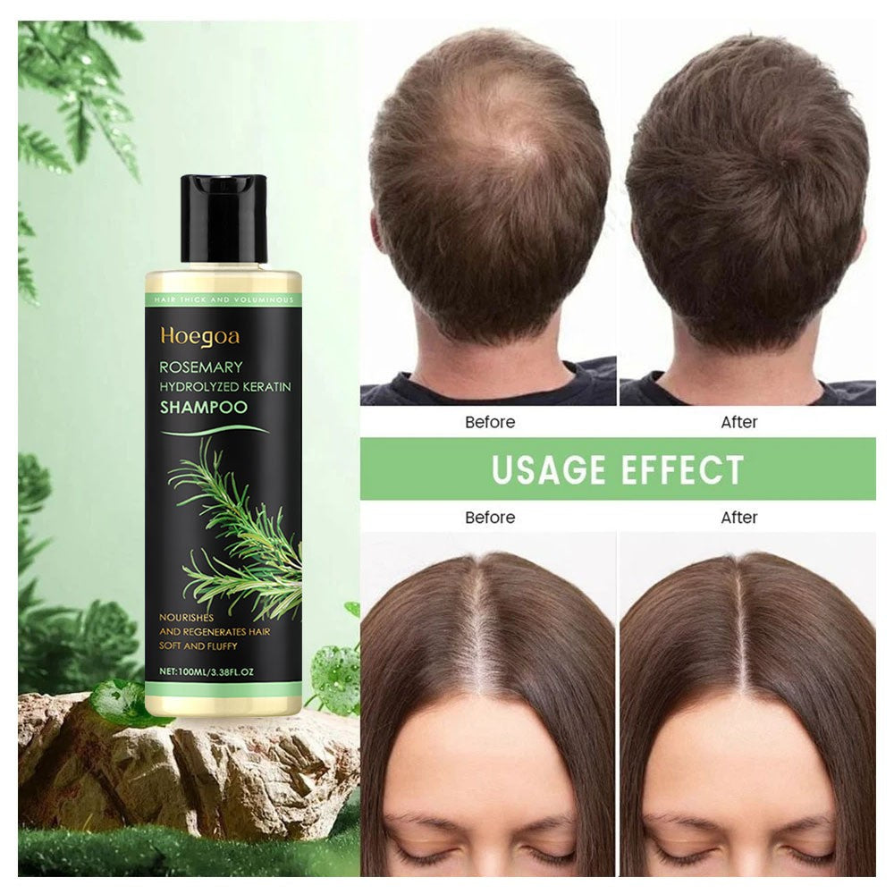 Organic Rosemary Hair Growth Shampoo for Thinning Hair & Anti-Hair Loss - 2 Pack