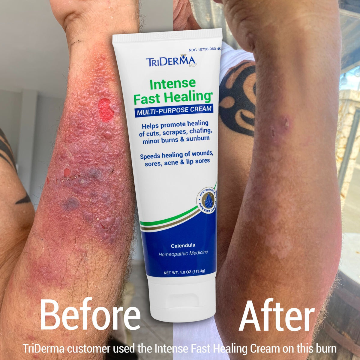 Fast Healing Cream for Face & Body - 4 oz Tube