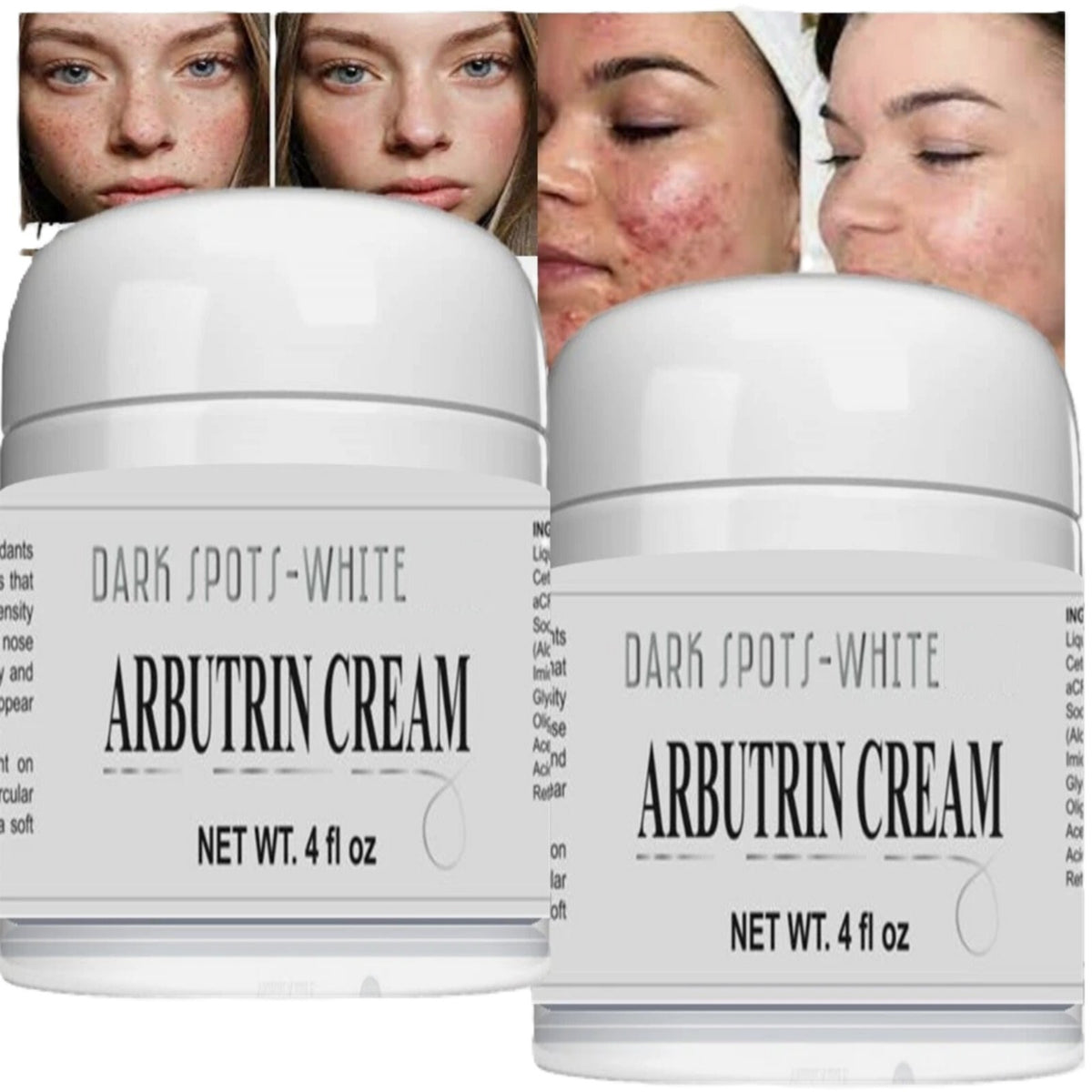 Facial Moisturizer with Aloe, Vitamin C & Collagen - 2 Jars