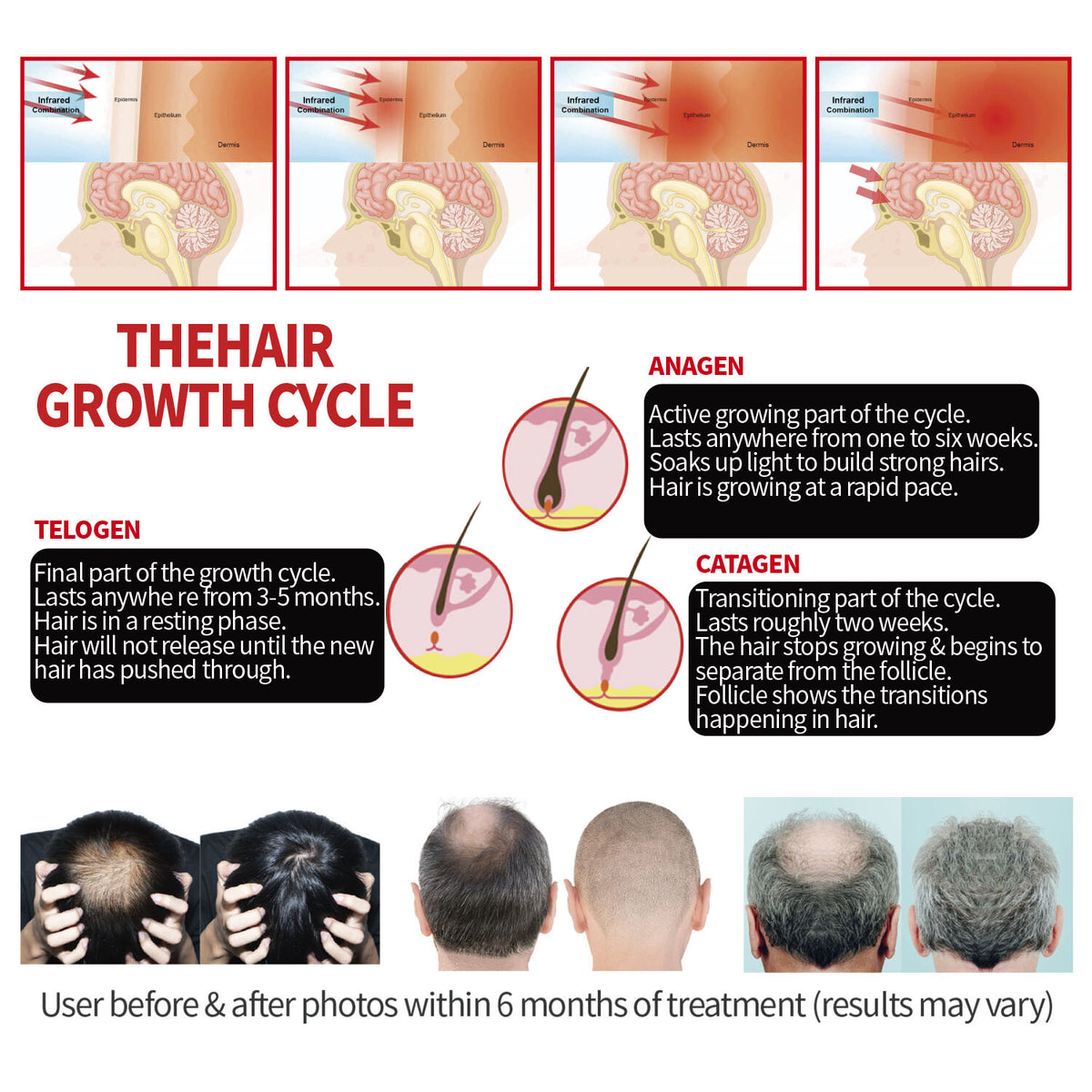 Infrared Red Light Therapy Helmet for Hair Loss & Regrowth