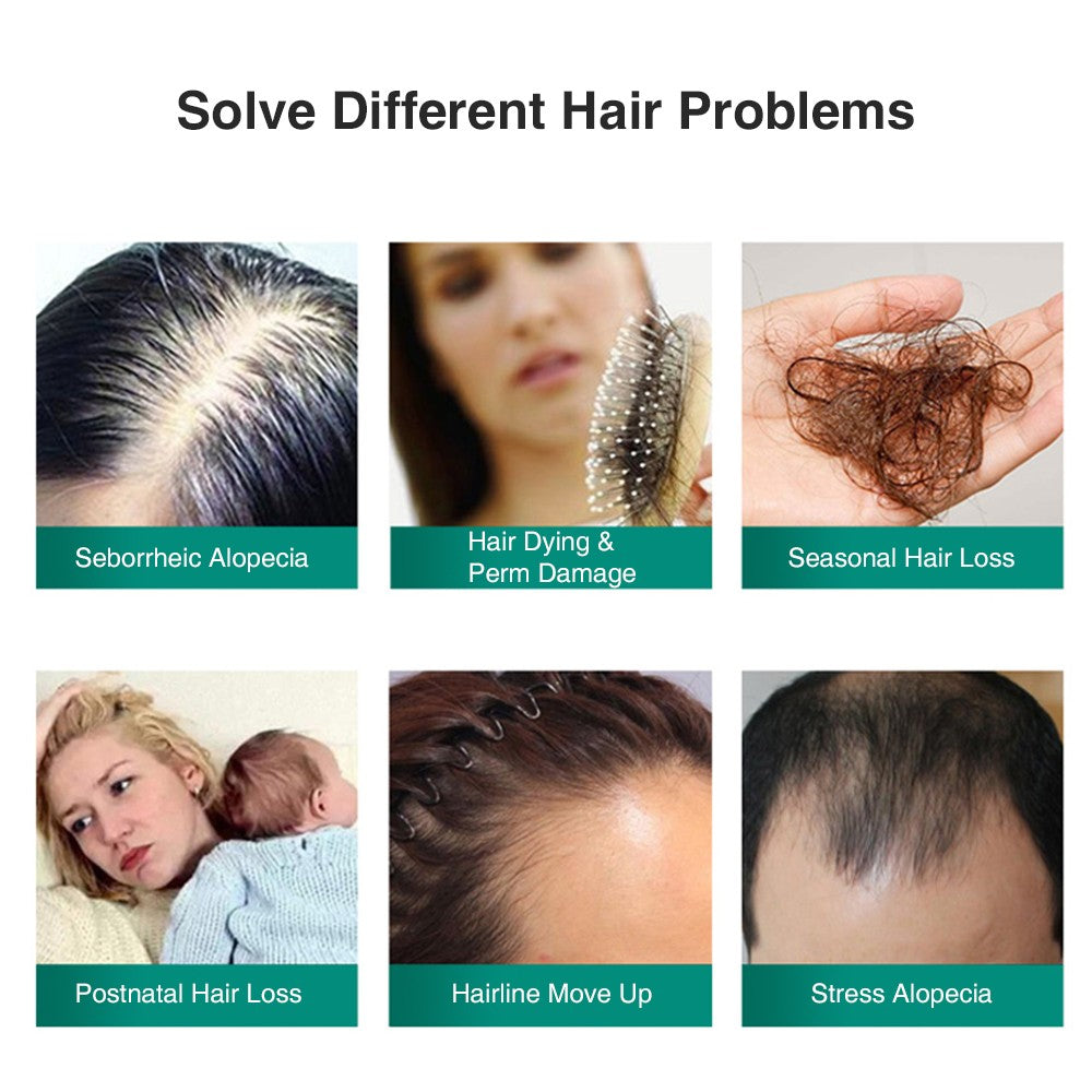 Anti-Hair Loss Shampoo for Men & Women, 200ml