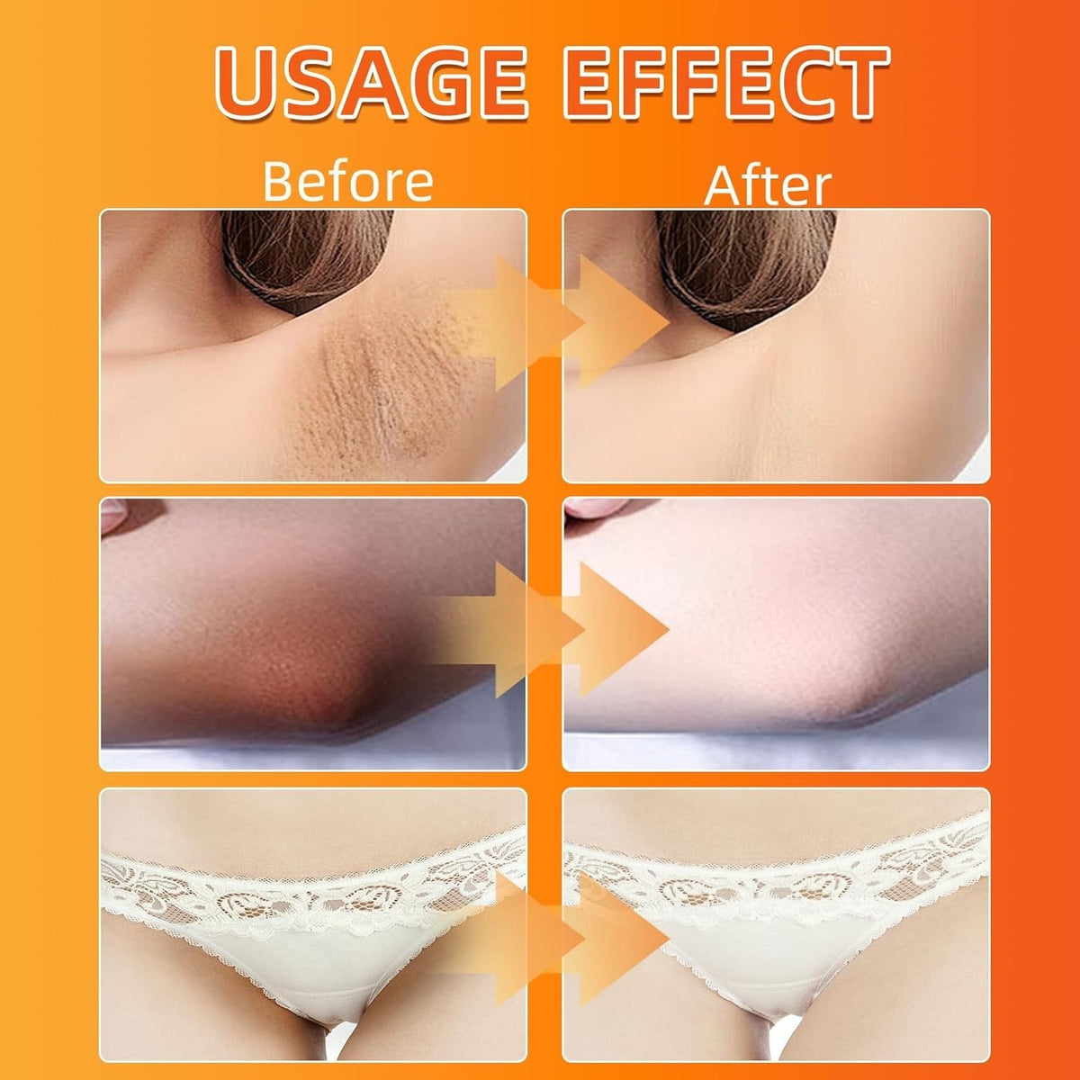 Skin Brightening Cream for Dark Spots & Sensitive Areas - All Skin Types