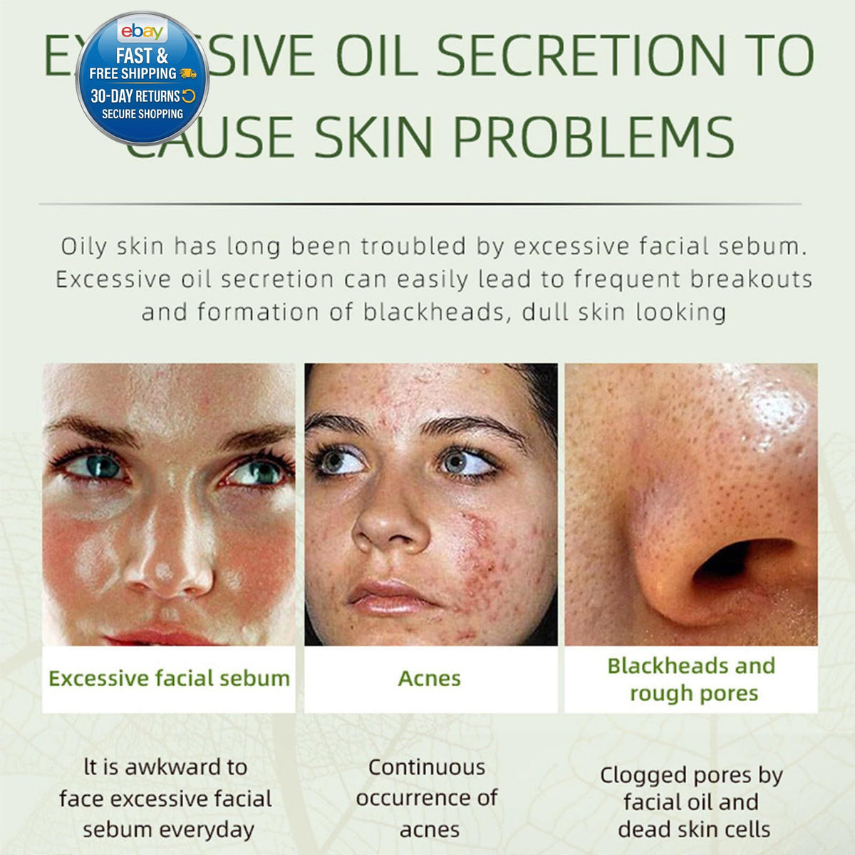 Herbal Acne Removing Face Cream for Oily Skin - Natural & Fast-Acting