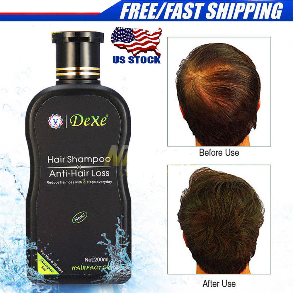 Herbal Anti-Hair Loss Shampoo for Thinning & Damaged Hair - 200ml