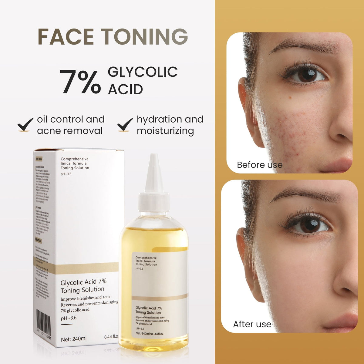 Glycolic Acid 7% Toner for Face Exfoliating Skin Resurfacing 240ml - Acne & Pore Care