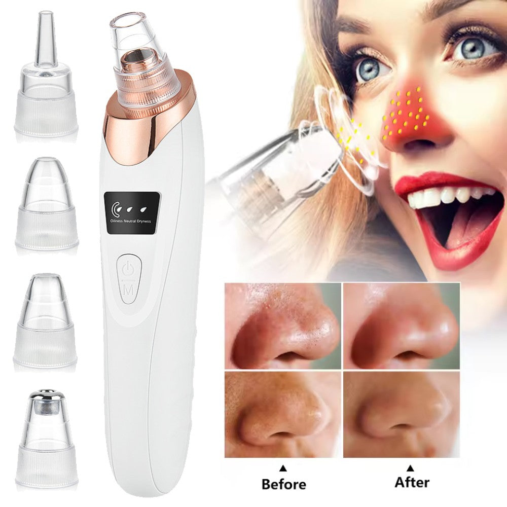 Electric Blackhead Remover Vacuum Pore Cleaner for Face – 5 Suction Heads, USB Rechargeable