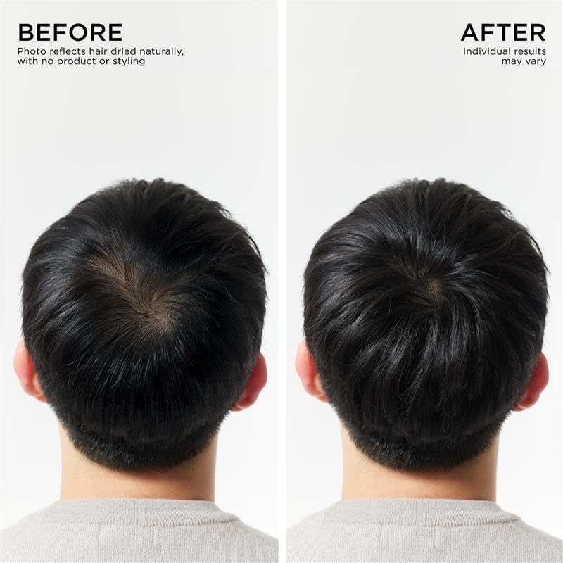 Hair Thickening Conditioner for Hair Loss & Thinning Hair - Biotin & Natural Extracts