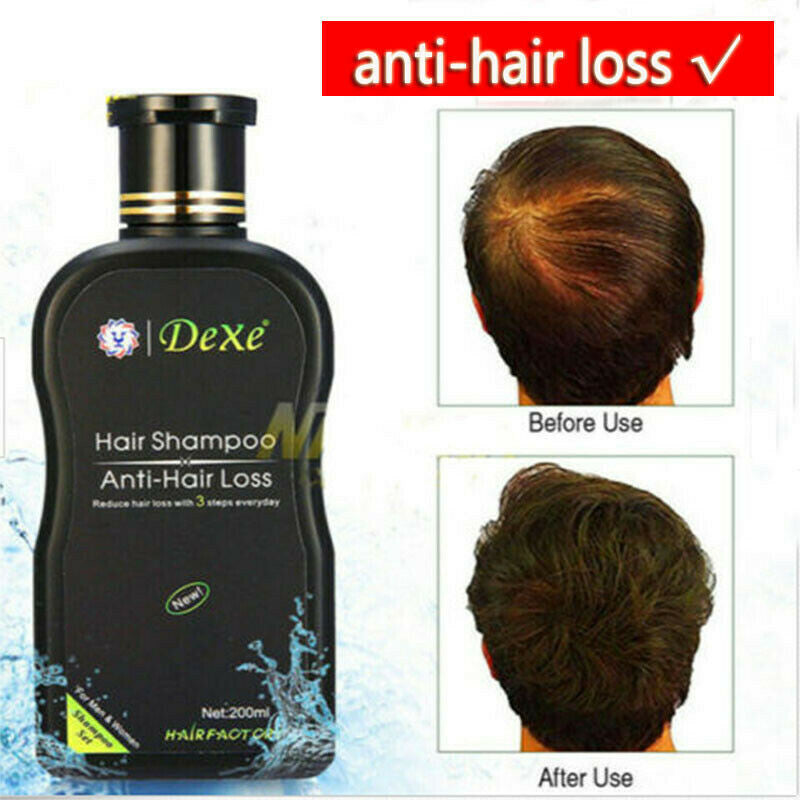 Anti-Hair Loss Shampoo 200ml - Herbal Hair Strengthening