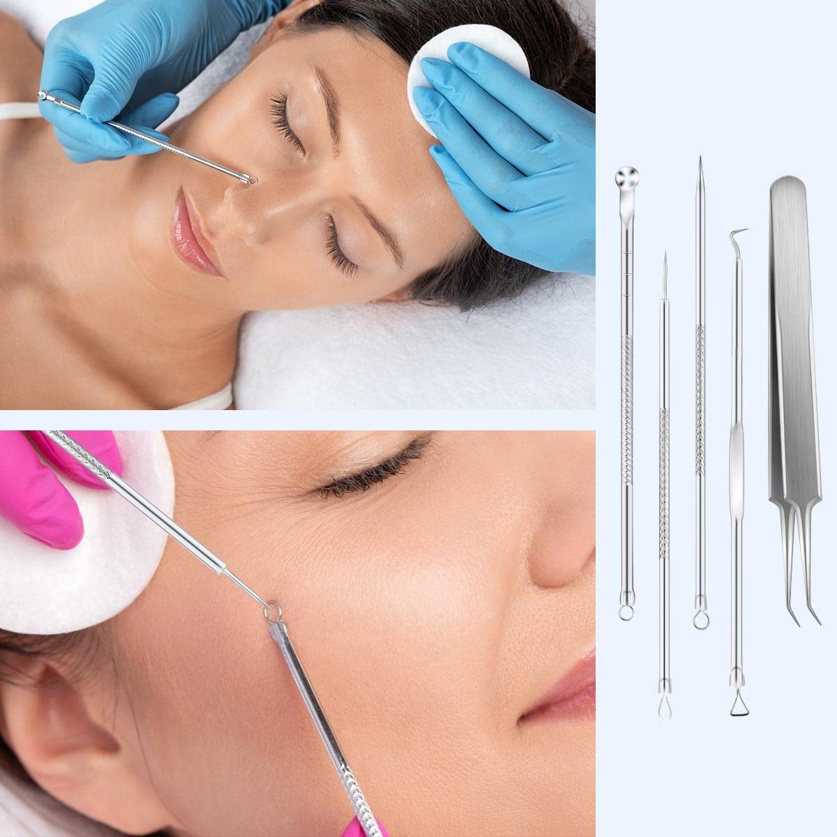 Blackhead Remover Tool Set - Pimple Extractor Kit with 5 Stainless Steel Tools