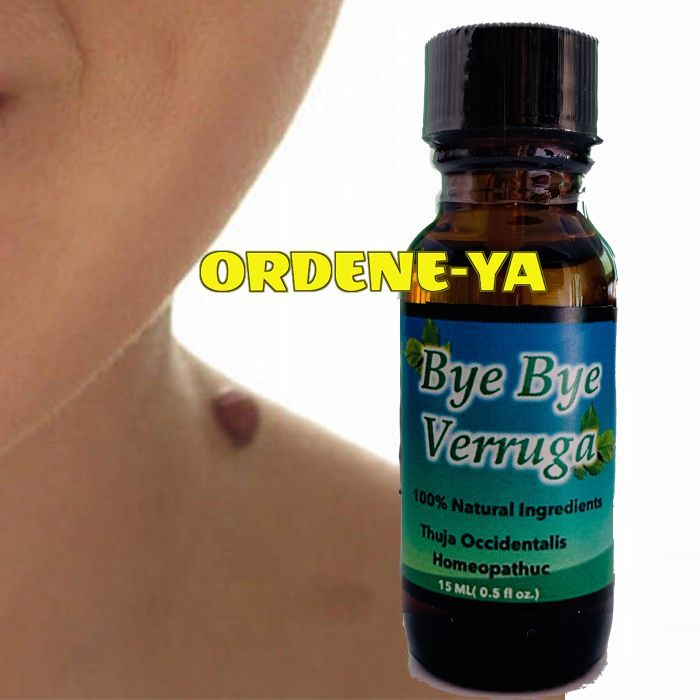 Natural Wart Remover with Thuja Occidentalis