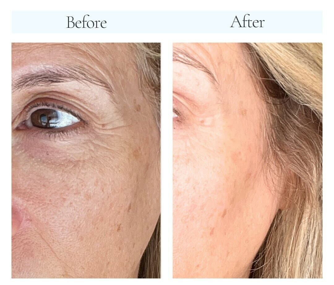 Anti-Aging Wrinkle Remover Cream - South Beach Skin Lab Repair Release 30ml