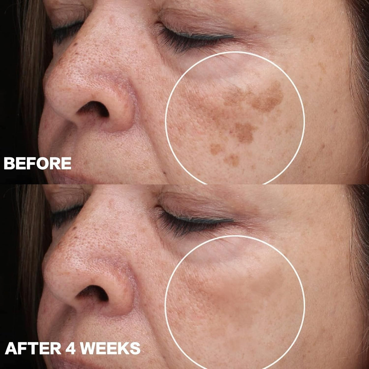 Dark Spot Remover Cream for All Skin Tones - Hydrating & Effective 1.7 FL OZ