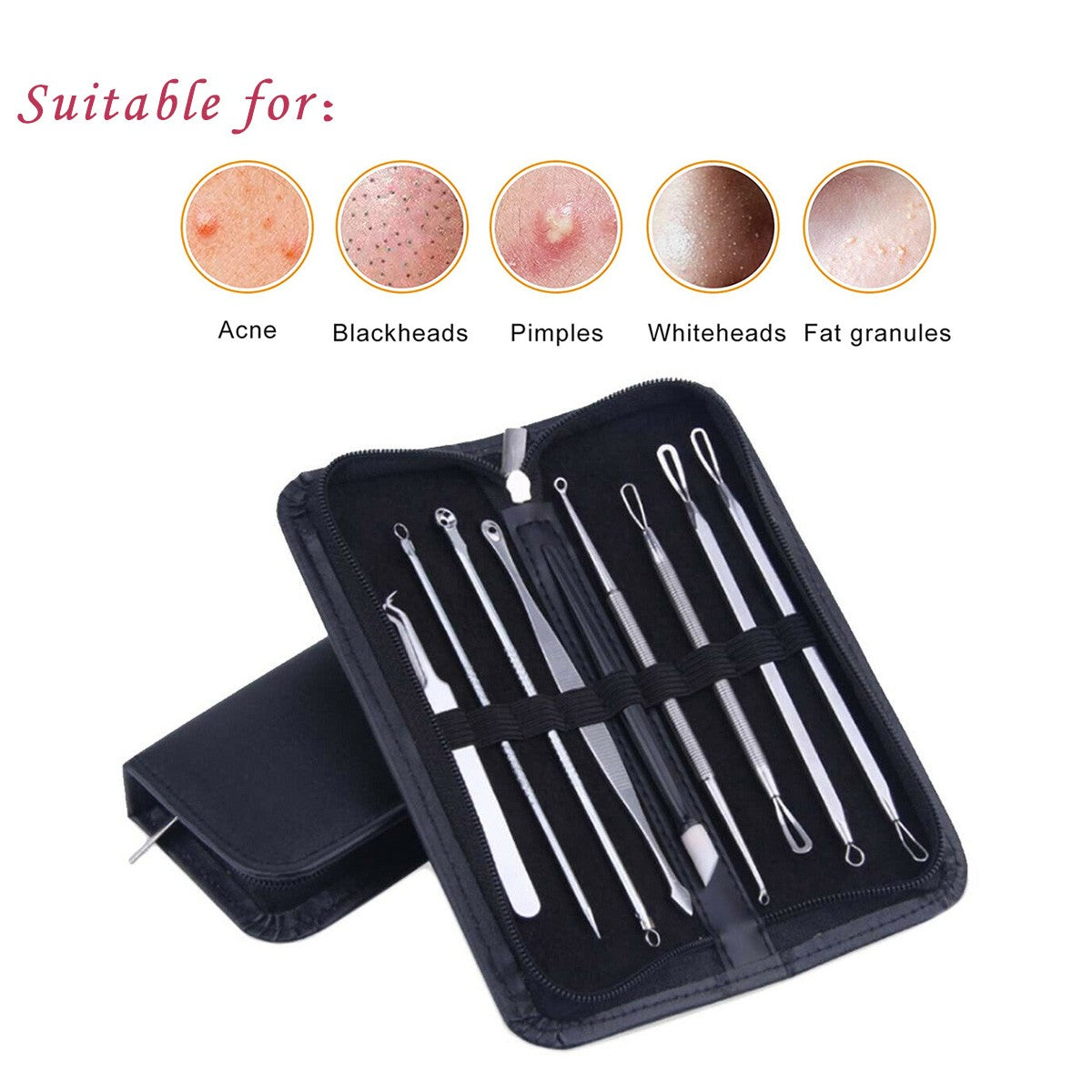 Blackhead Remover Tool Kit - Pimple Acne Extractor with Stainless Steel Needles