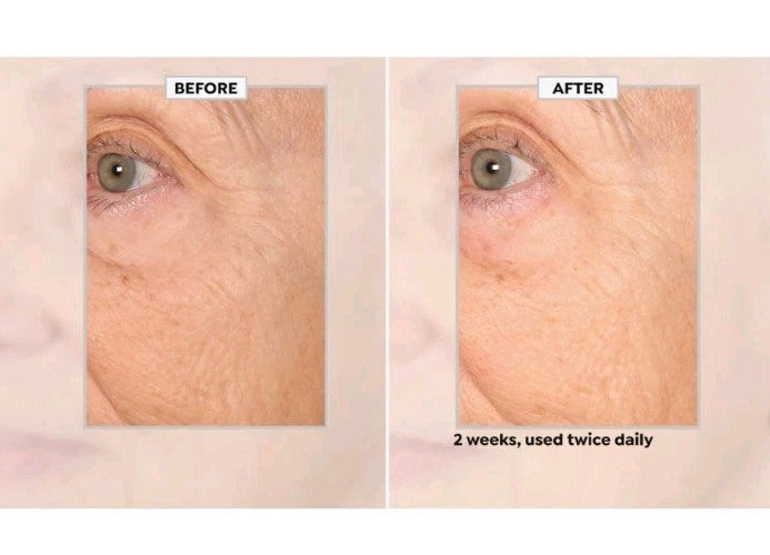 Black Rice Face Cream - Anti-Aging Moisturizer with Peptides & Antioxidants, 6.7 fl oz