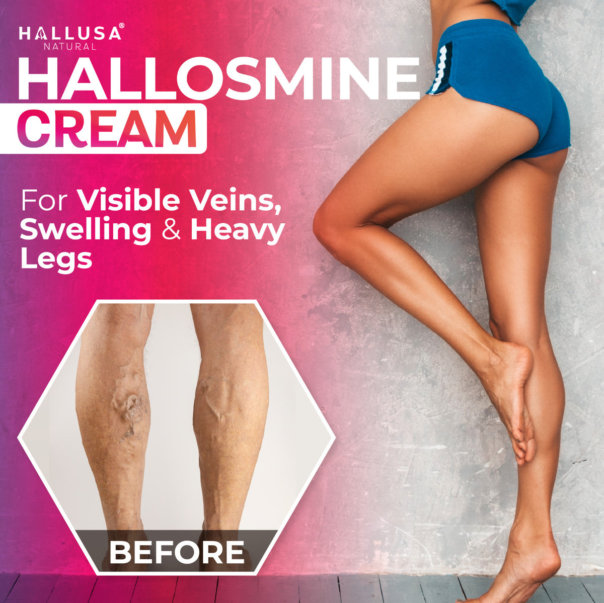 Varicose Veins Leg Cream - 4oz with Diosmin & Horse Chestnut