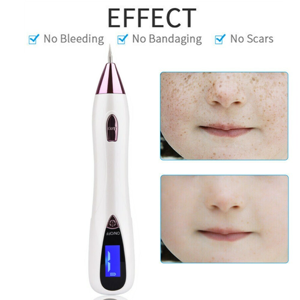 Rechargeable Plasma Pen for Eyelid Lift Wrinkle & Spot Removal Kit
