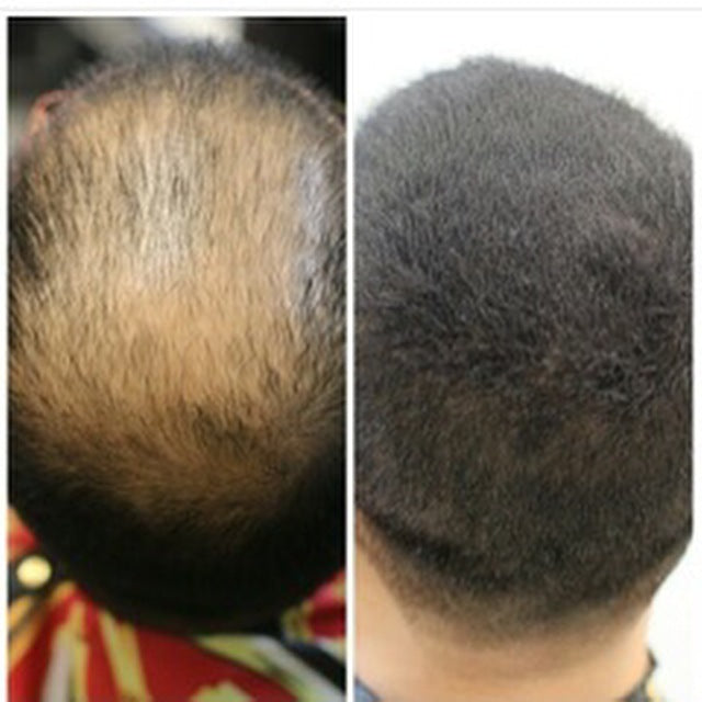 Hair Building Fibers - Real Hair Thickening Concealer (2x 38g)
