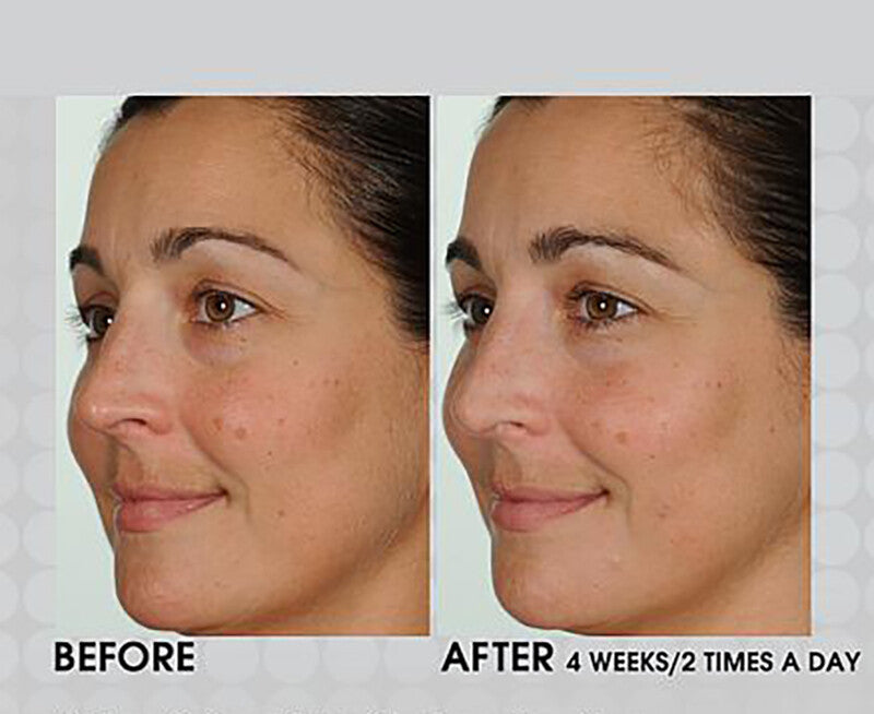 Anti-Aging Retinol Vitamin A Serum for Face - Fine Lines & Wrinkles Treatment