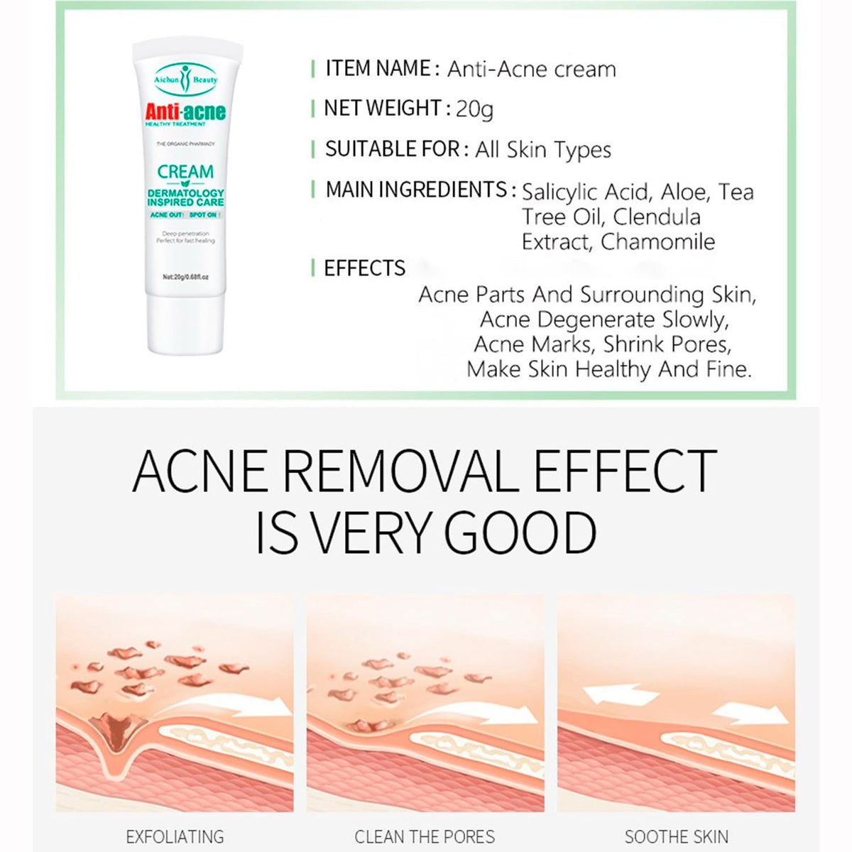 Anti-Acne Cream for Oily Skin Pores & Scar Reduction 20g