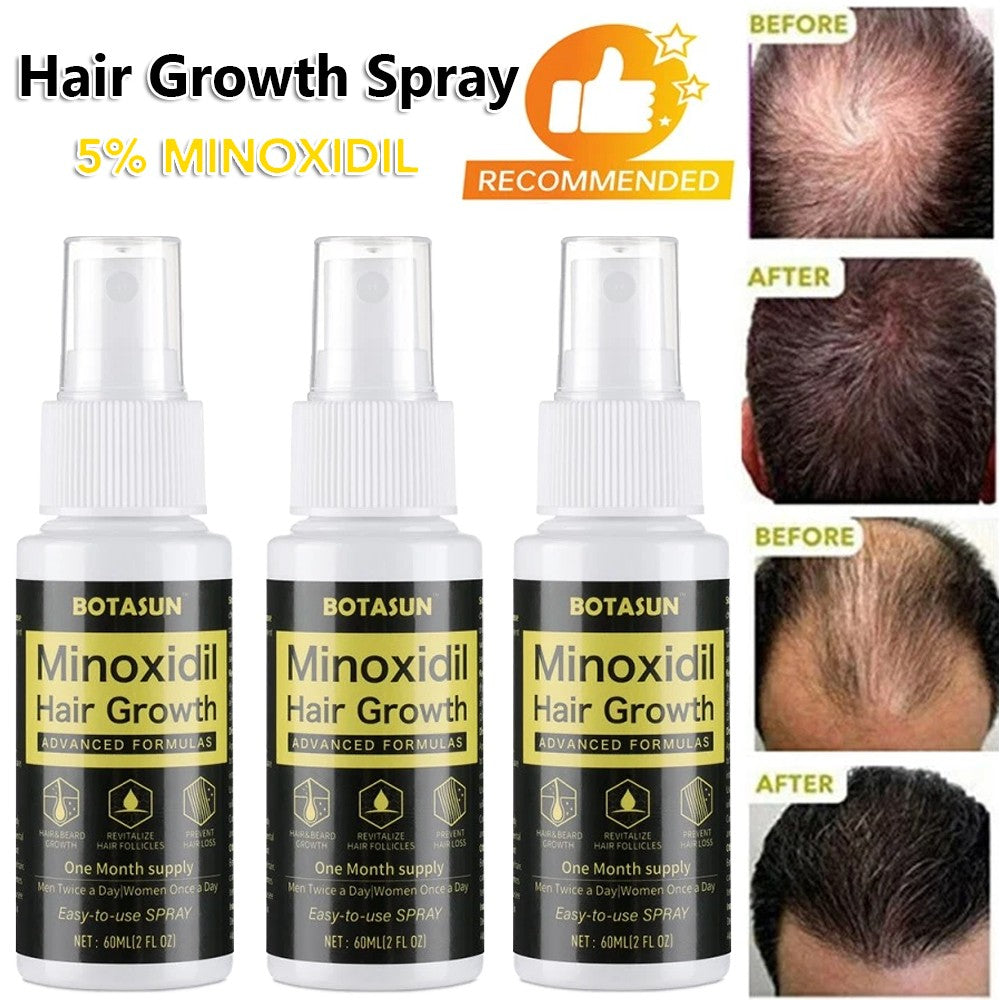 Minoxidil 5% Hair Regrowth Spray for Men - 3 Month Supply