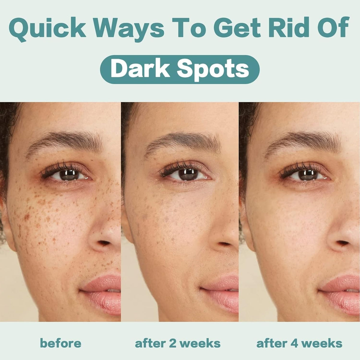 Dark Spot Corrector Cream for Hyperpigmentation & Uneven Skin Tone - 1.7 OZ